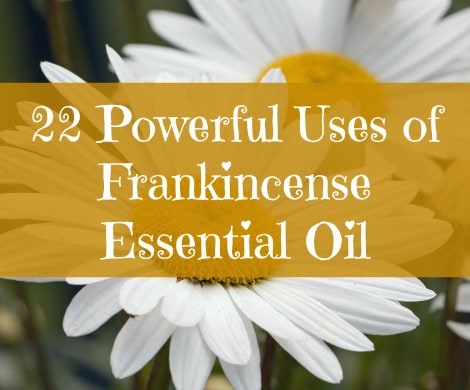 22 Uses of Frankincense