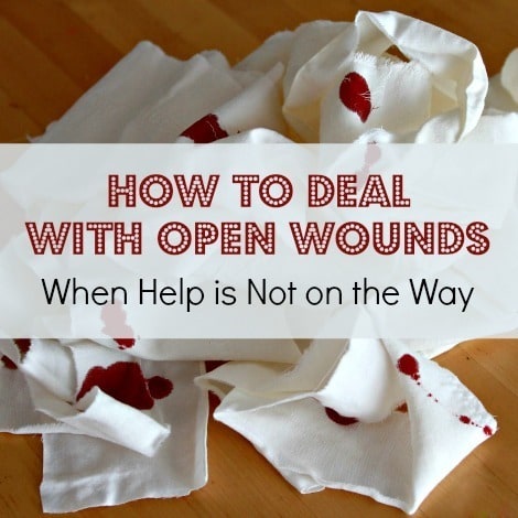 How to Deal With Open Wounds - Backdoor Survival