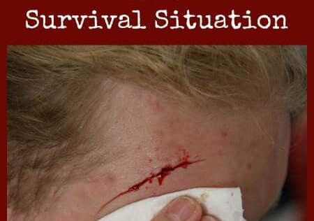Best Practices for Dealing with Wounds in a Survival Situation