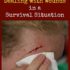 Best Practices for Dealing with Wounds in a Survival Situation