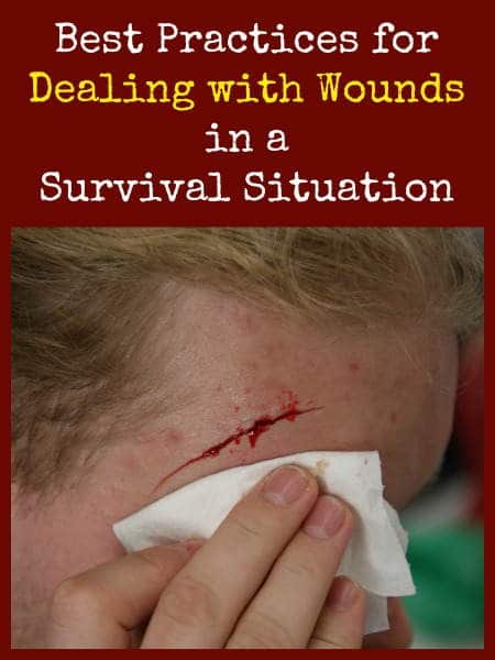 Dealing with Wounds in a Survival Situation | Backdoor Survival
