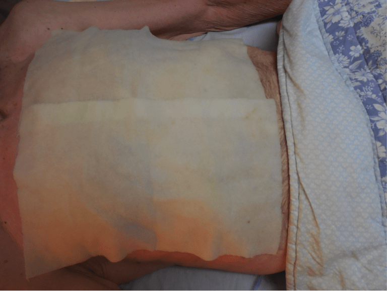 DIY Castor Oil Packs for Health Preparedness Backdoor Survival